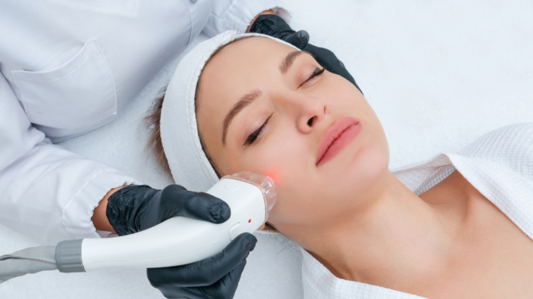 laser treatment