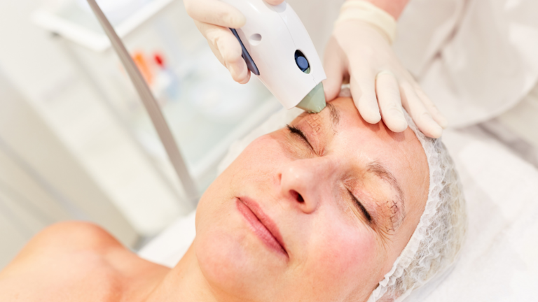 Thermage Treatments