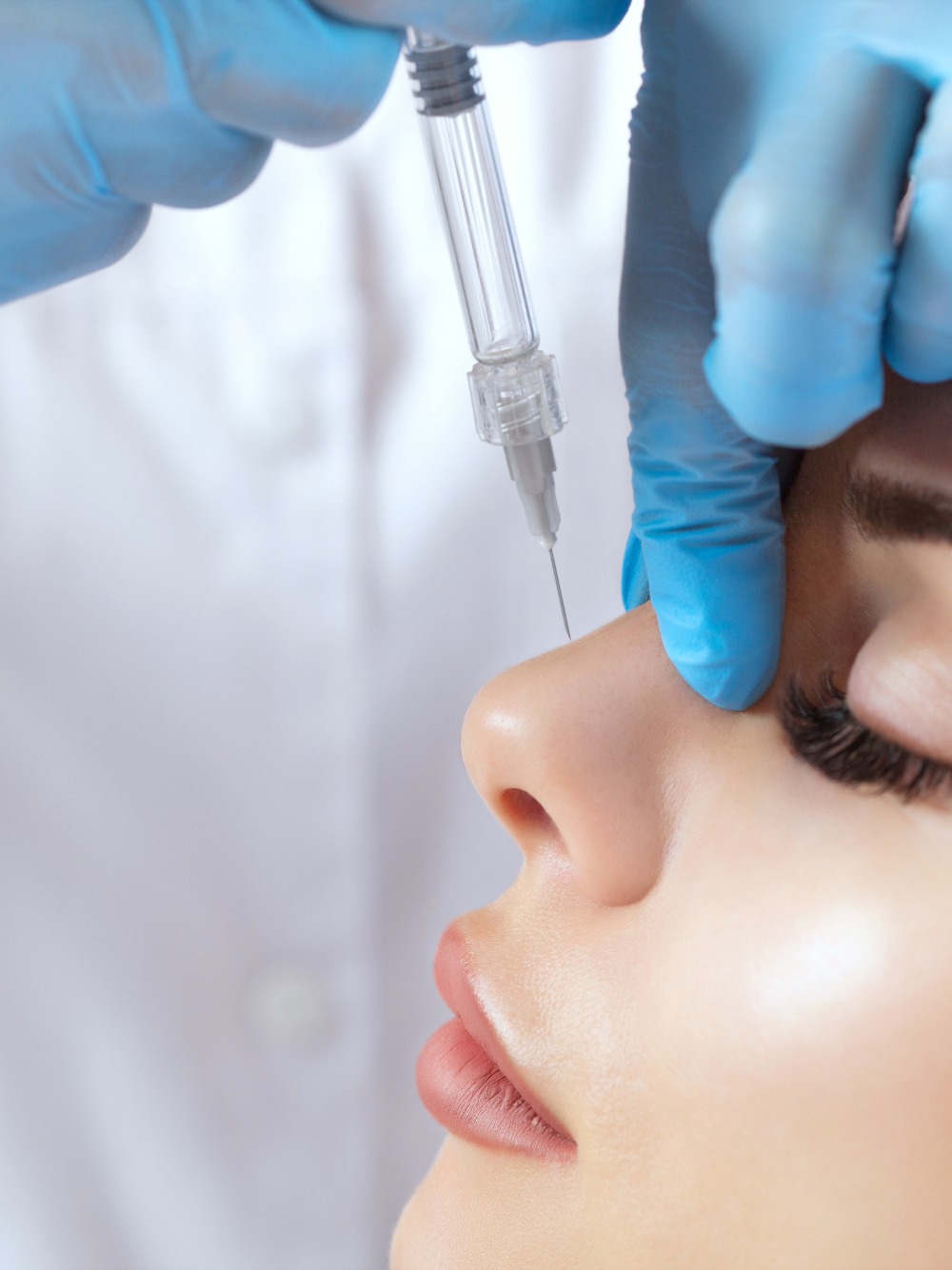 Nose filler injection