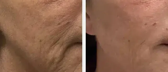 Photo comparison Ms Joanne McKeown_edited