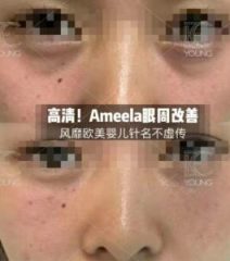 ameela-2