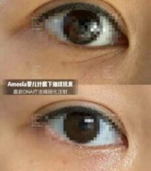ameela-4