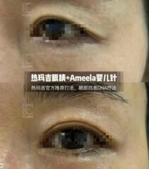 ameela-5