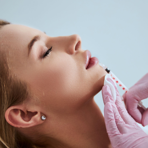 dermal fillers